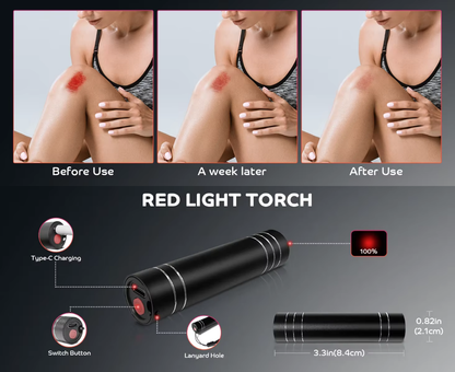Portable Red Light Therapy Torch – 660nm & 850nm Infrared Pain Relief Device